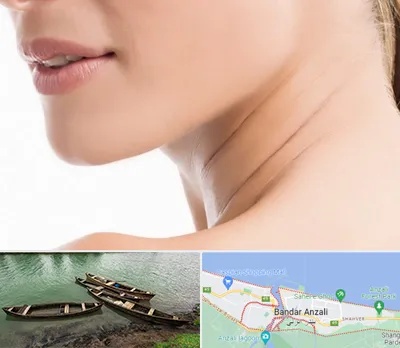 جراحی فک با لیزر در بندر انزلی