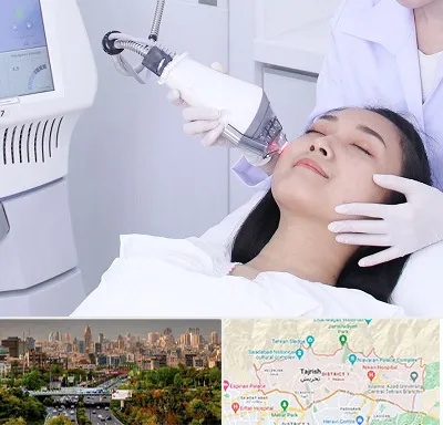 وایتنینگ در منطقه 1 تهران 