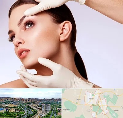 دکتر رفع غبغب در شهریار