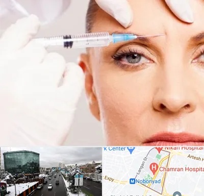 مزوژل در اقدسیه 