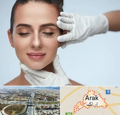عمل پف چشم در اراک