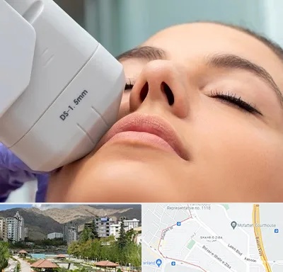 هایفوتراپی در شهر زیبا 