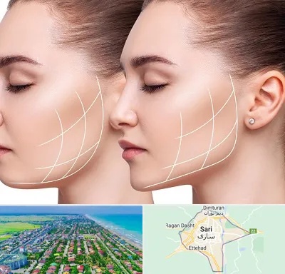 جراحی بوکال فت در ساری
