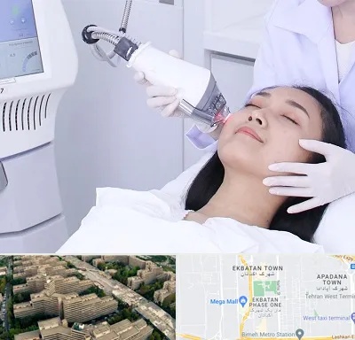 وایتنینگ در اکباتان 