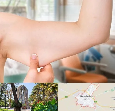 براکیوپلاستی در نیشابور