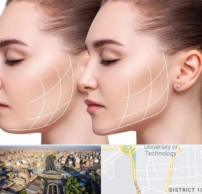 جراحی بوکال فت در استاد معین 