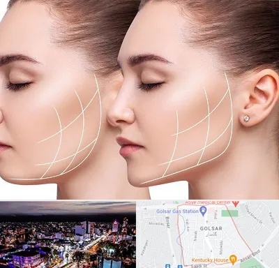 جراحی بوکال فت در گلسار رشت 