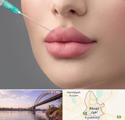 کلینیک ژل لب روسی در اهواز