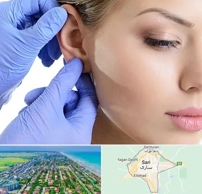 اتوپلاستی در ساری