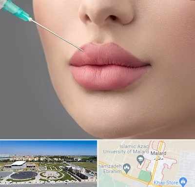 کلینیک ژل لب روسی در ملارد
