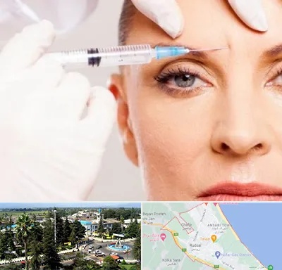 مزوژل در رودسر