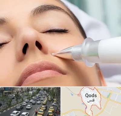 پلاسما جت بینی در شهر قدس