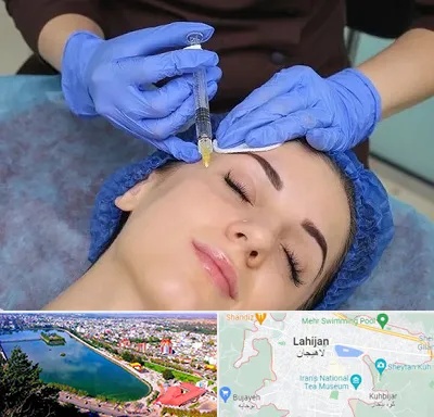 تزریق پروفایلو در لاهیجان