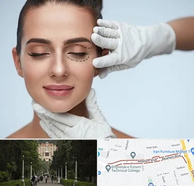 عمل پف چشم در بلوار معلم رشت 