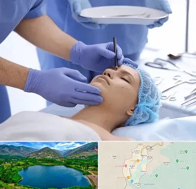 عمل بینی طبیعی در رودبار