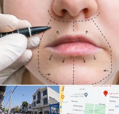 عمل سانترال لب در افسریه 