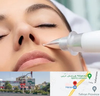 پلاسما جت بینی در هروی 