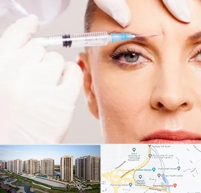 مزوژل در المپیک 