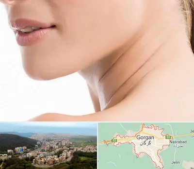 جراحی فک با لیزر در گرگان