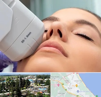 هایفوتراپی در رودسر