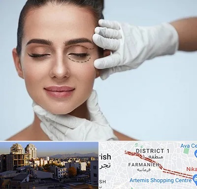 عمل پف چشم در فرمانیه 