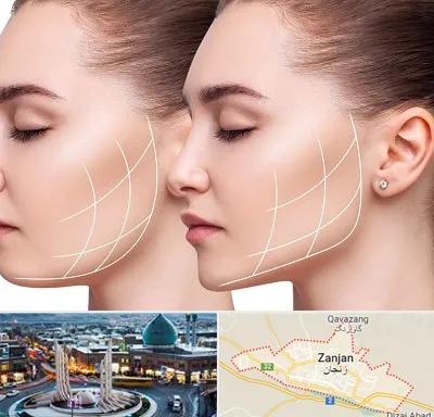 جراحی بوکال فت در زنجان