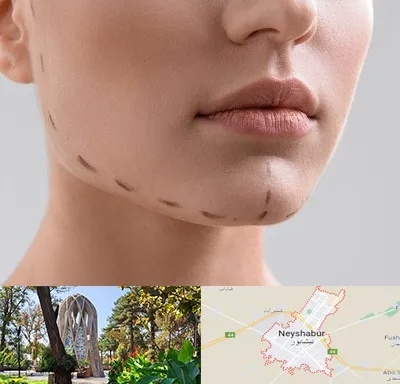 عمل زاویه فک در نیشابور