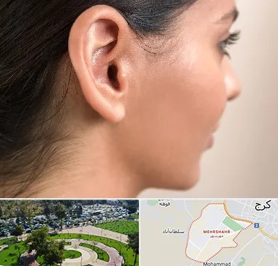 عمل گوش بل در مهرشهر کرج 