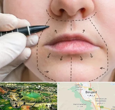 عمل سانترال لب در بروجرد