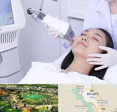 وایتنینگ در بروجرد