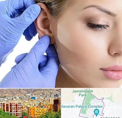 اتوپلاستی در نیاوران 