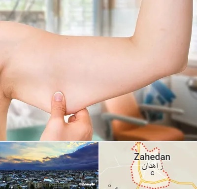 براکیوپلاستی در زاهدان