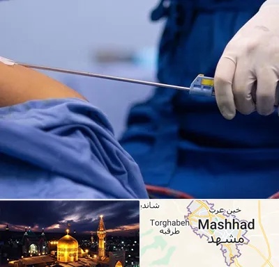 پیکر تراشی در مشهد