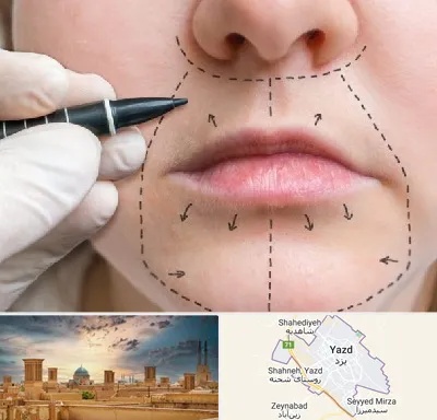 عمل سانترال لب در یزد
