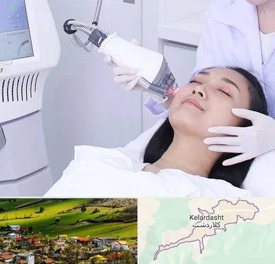 وایتنینگ در کلاردشت