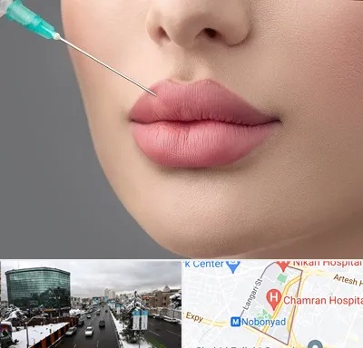 کلینیک ژل لب روسی در اقدسیه 