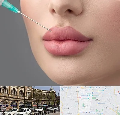 کلینیک ژل لب روسی در منطقه 11 تهران 