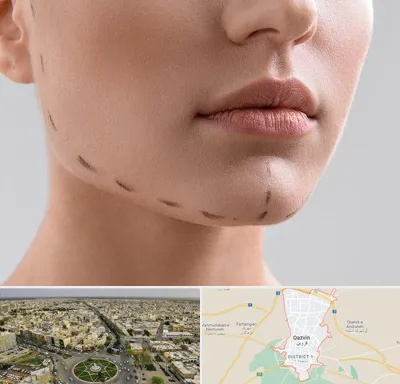 عمل زاویه فک در قزوین