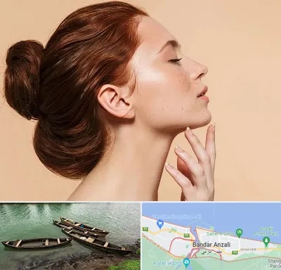 جراحی غبغب در بندر انزلی