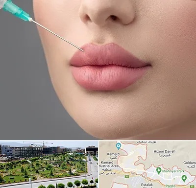 کلینیک ژل لب روسی در پردیس