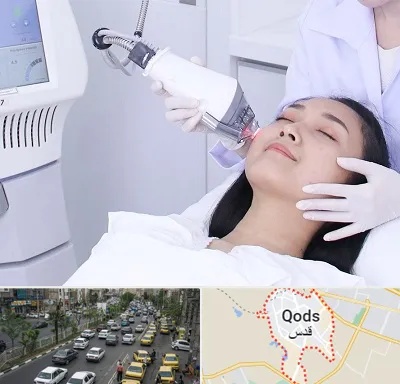 وایتنینگ در شهر قدس