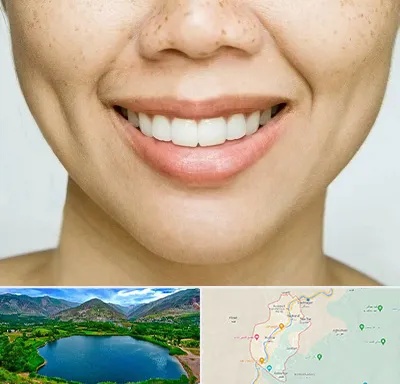 عمل چال گونه در رودبار