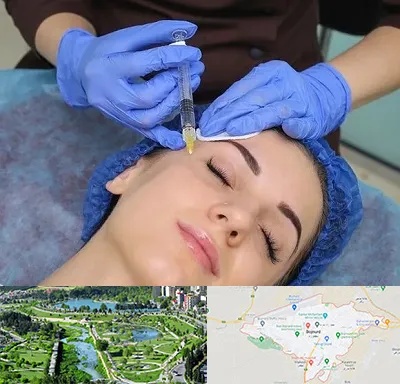تزریق پروفایلو در بجنورد