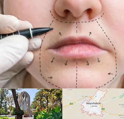 عمل سانترال لب در نیشابور