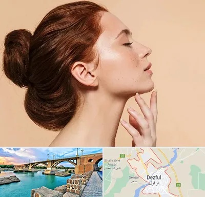 جراحی غبغب در دزفول