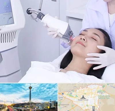 وایتنینگ در تهران