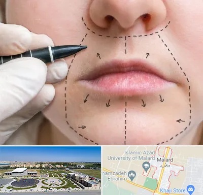 عمل سانترال لب در ملارد