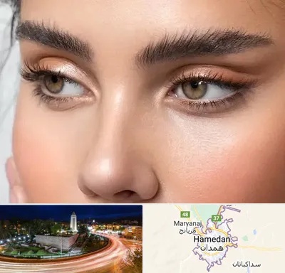 کانتو پلاستی در همدان