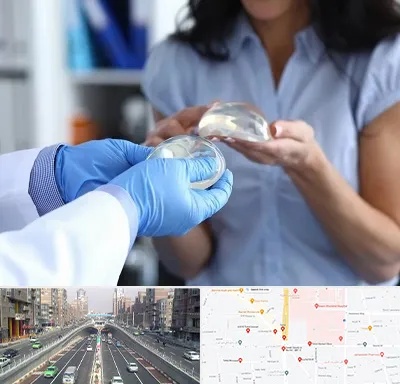 پروتز باسن در توحید 
