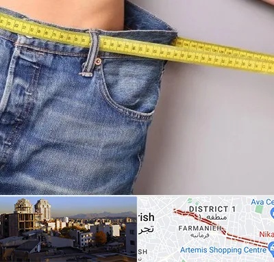 عمل لیپوماتیک در فرمانیه 
